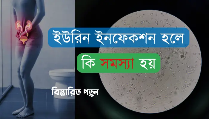 ইউরিন ইনফেকশন হলে কি সমস্যা হয় এবং দূর করার উপায় ইউরিন ইনফেকশন হলে কি সমস্যা হয়