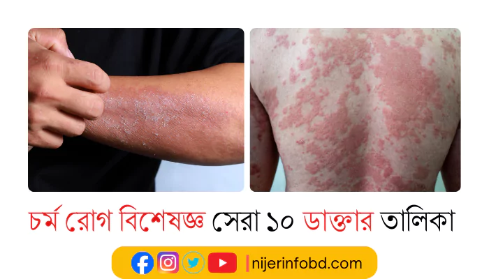 চর্ম রোগ বিশেষজ্ঞ ১০০% সেরা ১০ ডাক্তার তালিকা ও যোগাযোগ মাধ্যম চর্ম রোগ বিশেষজ্ঞ সেরা ১০ ডাক্তার তালিকা ও যোগাযোগ মাধ্যম