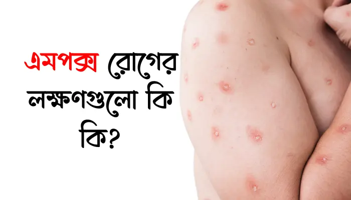 এমপক্স রোগের লক্ষণগুলো কি কি? এ সম্পর্কে বিস্তারিত জানুন এমপক্স রোগের লক্ষণগুলো কি কি?
