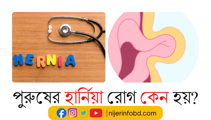 পুরুষের হার্নিয়া রোগ কেন হয়? হার্নিয়া সম্পর্কে বিস্তারিত পুরুষের হার্নিয়া রোগ কেন হয়?