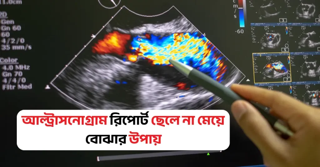 আল্ট্রাসনোগ্রাম রিপোর্ট ছেলে না মেয়ে বোঝার সহজ উপায় আল্ট্রাসনোগ্রাম রিপোর্ট