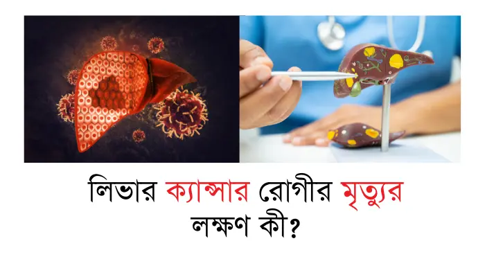 লিভার ক্যান্সার রোগীর মৃত্যুর লক্ষণ কী? বিস্তারিত জেনে নিন লিভার ক্যান্সার রোগীর মৃত্যুর লক্ষণ কী?